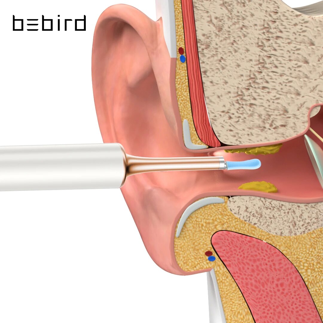 Bebird T15 Visual Ear Cleaner (White)