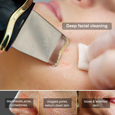 🔥Limited Time Offer 🔥Ultrasonic Blackhead Remover Pore Cleaner Face Scraper Comedone